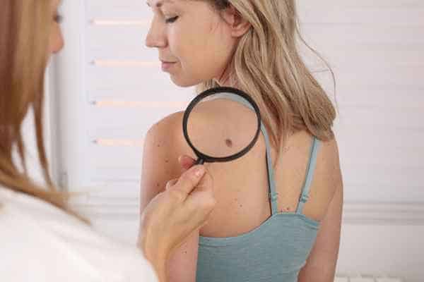 What Are Traditional Skin Lesion Removal Methods Newbury?