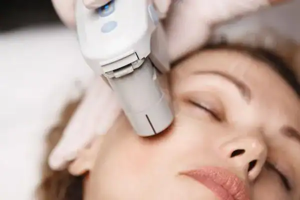 HIFU non-surgical treatment