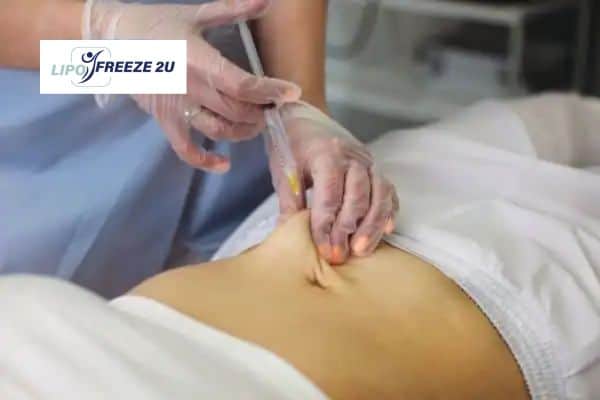 How Does Aqualyx Fat Dissolving Injection Work to Break Down Fat Newbury?
