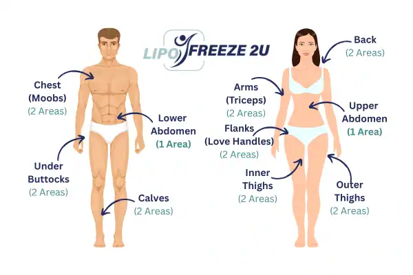 Areas you can have fat freezing treatment Newbury