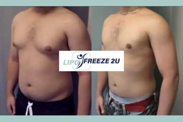 How Long Does It Take to See Results Newbury?