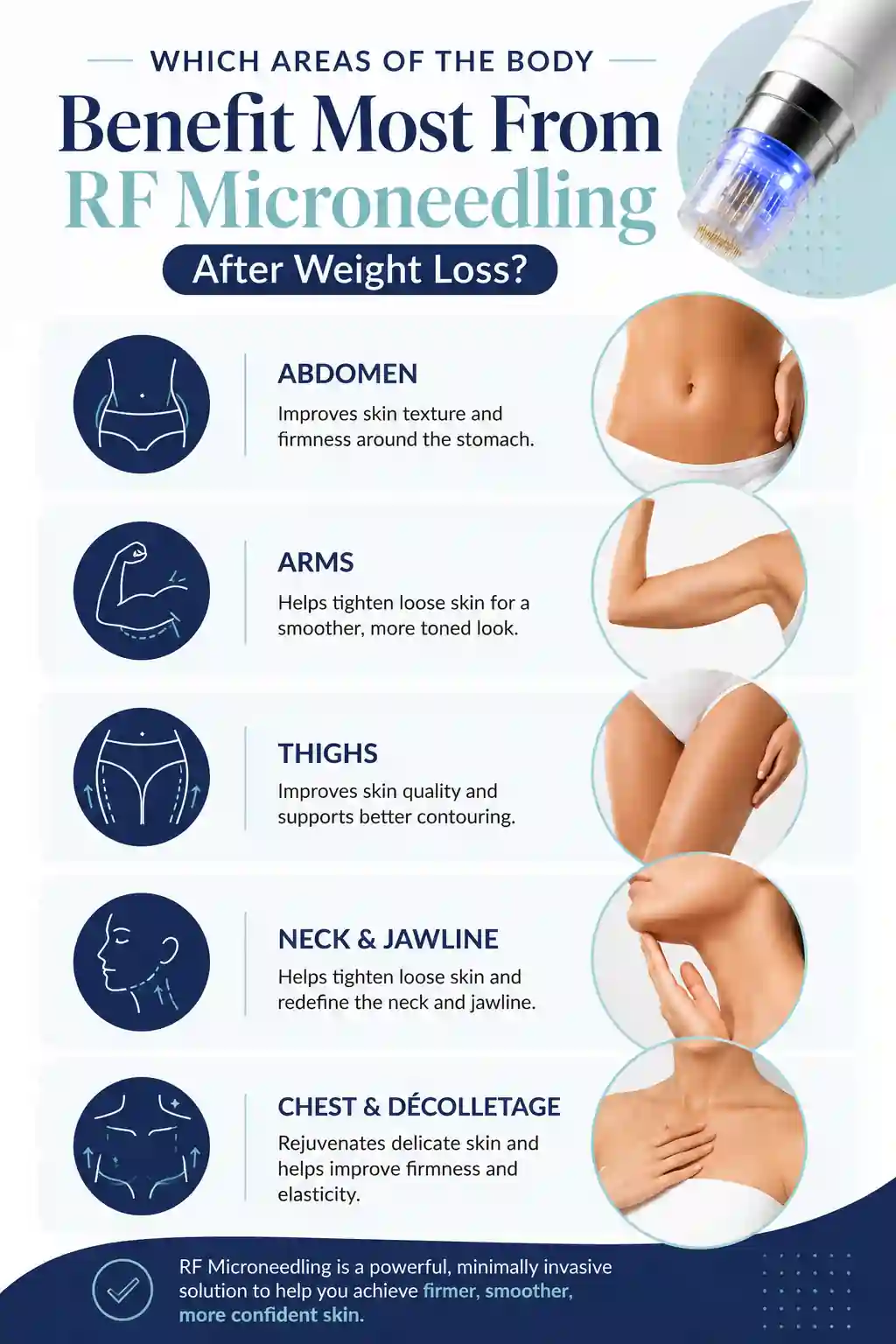 Which Areas of the Body Benefit Most From RF Microneedling After Weight Loss Newbury